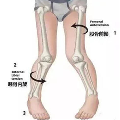 贝嫂抱孩子有多优雅你抱孩子就有多坑娃别把孩子抱瘸了再后悔