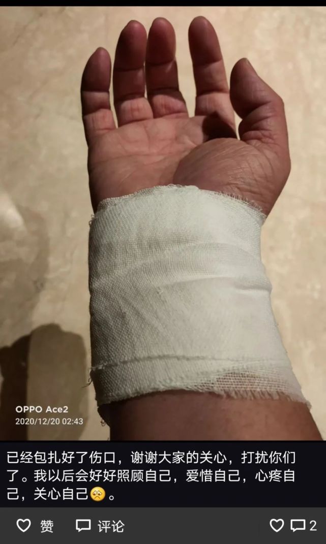 但接着,夏花又发朋友圈表示已经包扎好了伤口,并且在十来个微信群告知
