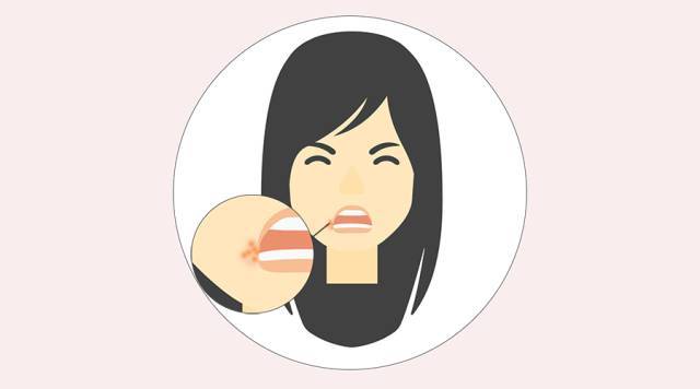 烂嘴角不是上火,是病毒感染!