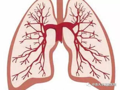 特发性肺纤维化为什么会找上我 特发性肺纤维化 Ipf 胃食管反流病 吸烟 纤维化