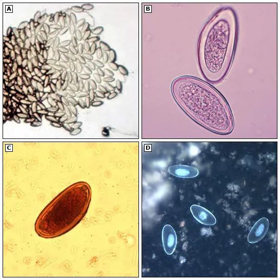 其实,半夜肛门瘙痒的孩子多半是蛲虫感染了,因为蛲虫总是在半夜偷偷地