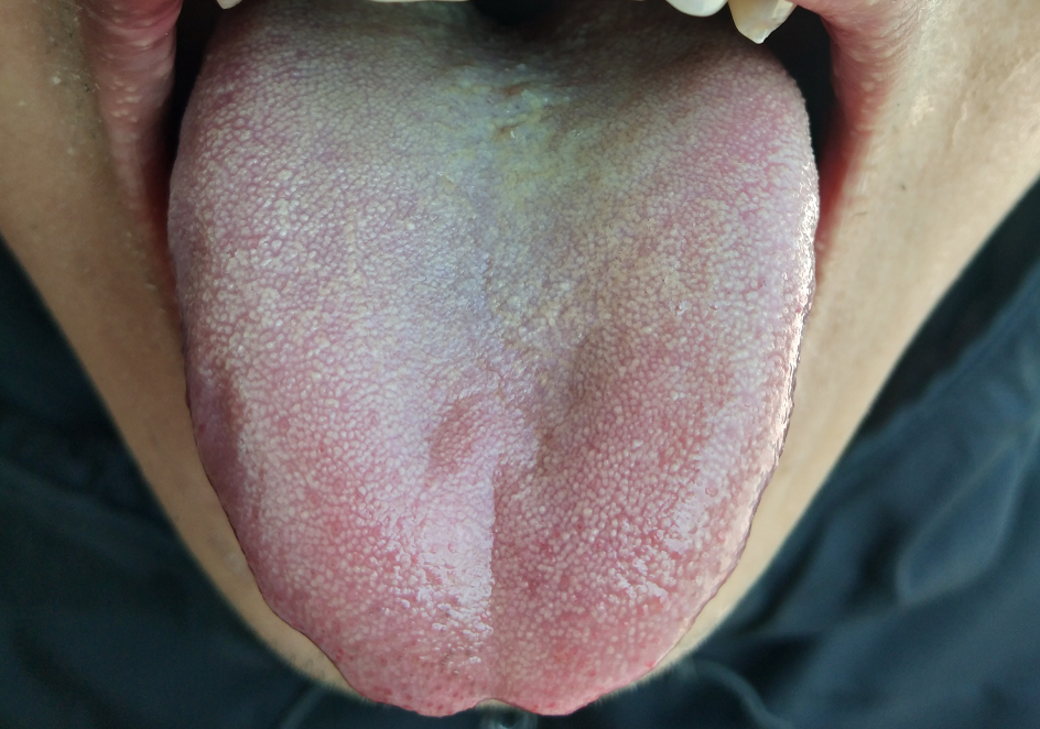 流感季节,学习中医知识,保护家人健康!