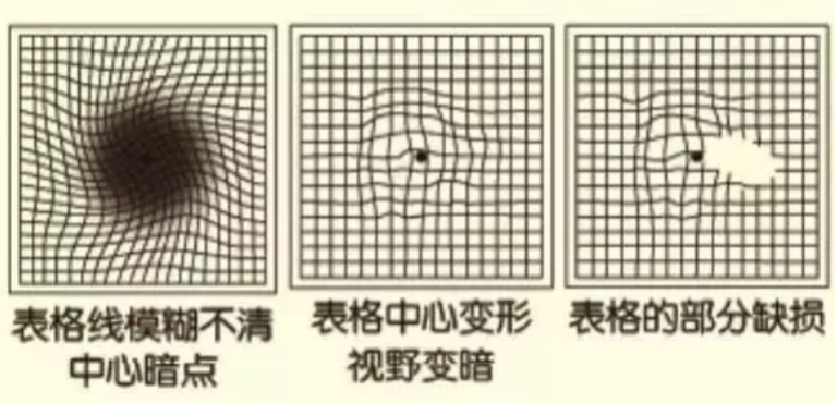 视物变形自测图片