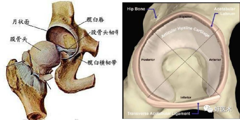 解剖结构异常而引发股骨近端与髋臼间发生撞击,导致髋关节盂唇和关节
