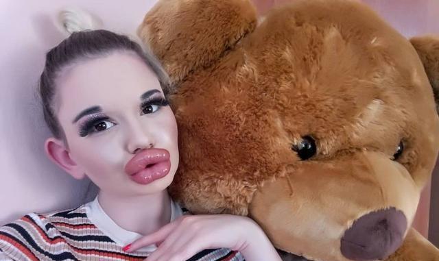 国外女子疯狂丰唇21次超大腊肠嘴快能碰到鼻子网友辣眼睛