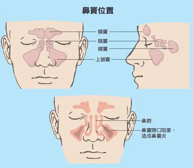 它們隱蔽在鼻腔旁邊,分別是額竇,蝶竇,篩竇,上頜竇等四對鼻竇.清鼻堂