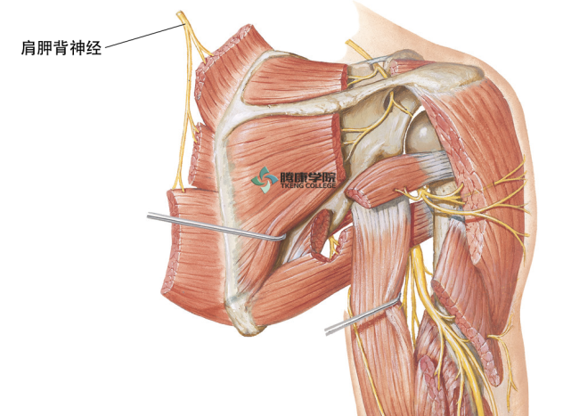 肩胛背神经卡压 肩胛提肌 神经根