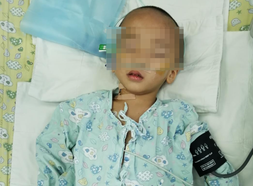 5岁男童肚中暗藏巨大神经母细胞瘤医护6小时联手取出