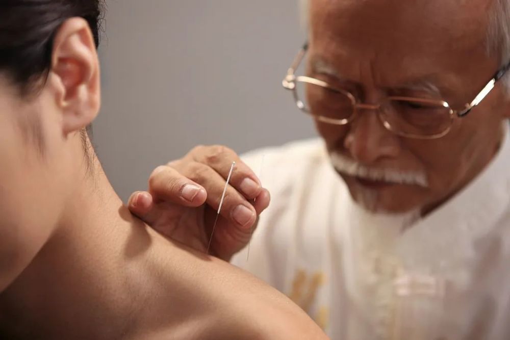 针灸治疗肩凝证临床常用穴位及刺法