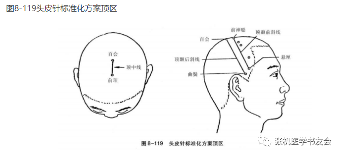 4.顶旁1线在头顶部,位于顶中线外侧,距顶中线1.