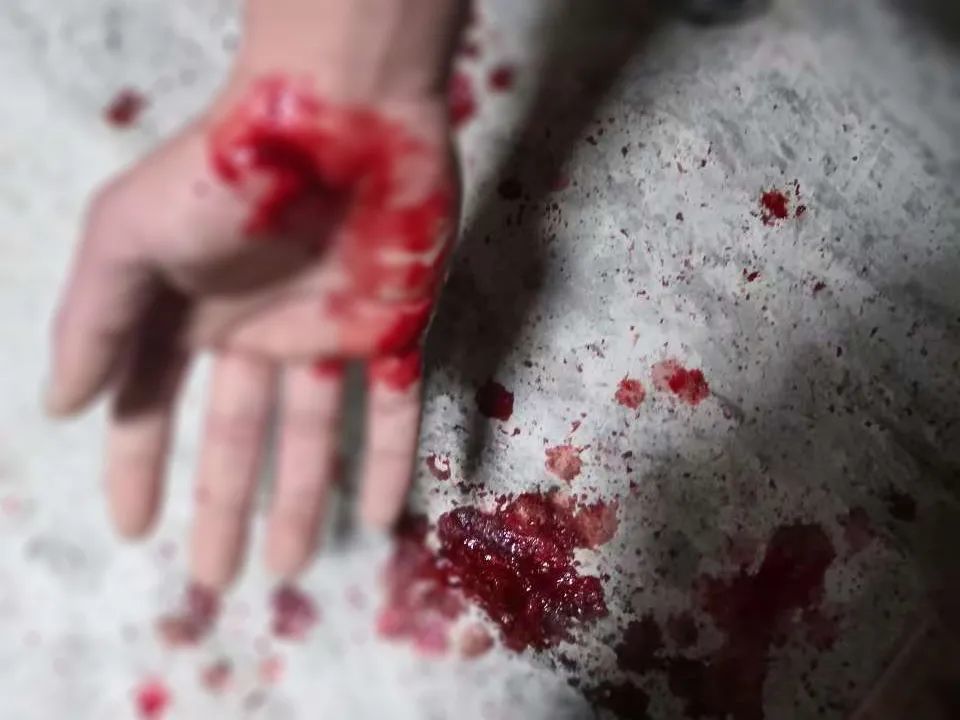 碎玻璃扎入手掌,温州民警仍坚持冲了上去_腾讯新闻