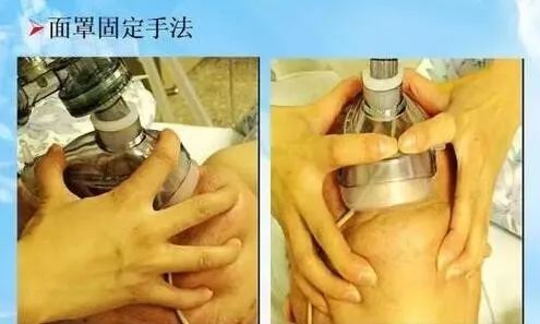 简易呼吸气囊,你们都用对了吗?_腾讯新闻