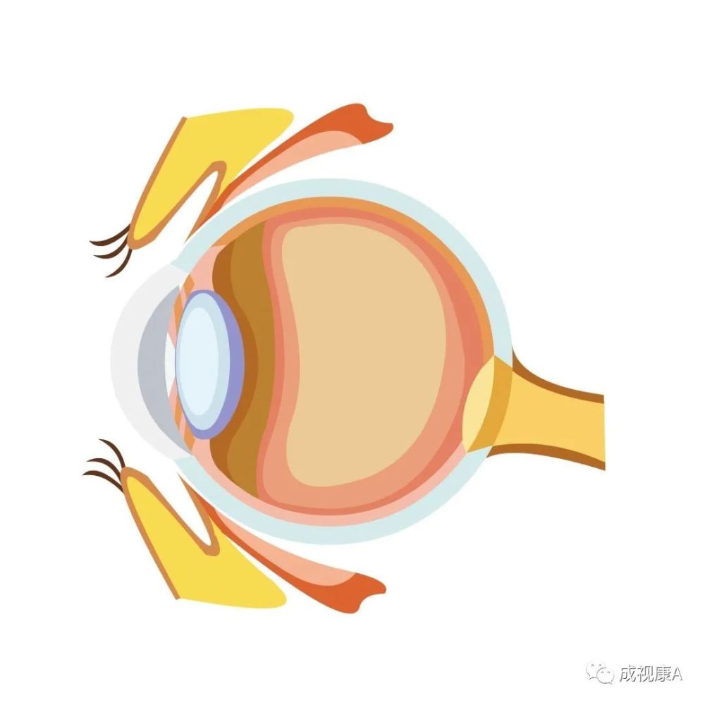 高度近视|近视600度以上，不仅会损伤眼底，还会导致这种病！