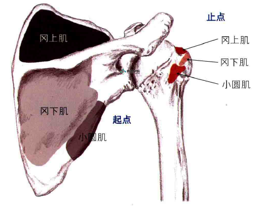 岡上肌肌腱炎的症狀隨著受傷部位的不同而異,一般是出力做肩關節外展