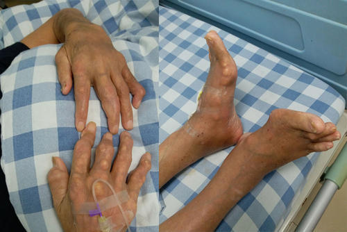 男性毁肾的3大习惯很多人控制不住得注意改改了