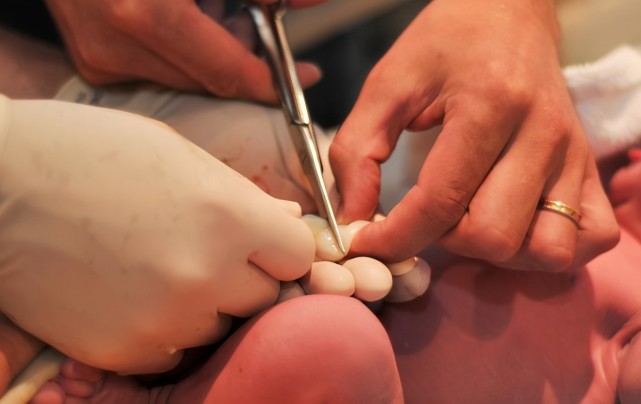 宝宝出生后为何剪脐带时他会哇哇大哭很疼吗医生说了大实话