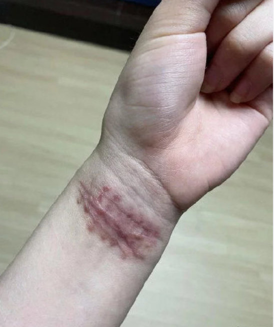 韩女星权珉娥自曝遭前队友霸凌十年,如今还被逼以父亲名义起誓