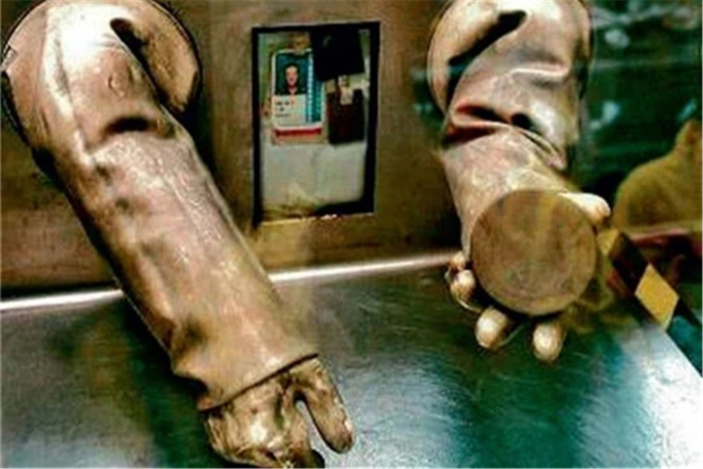 日本男子被医生救治83天,只能看着自己皮肤腐烂!