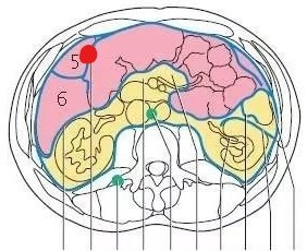 ct可以看到网膜囊嘛?能知道有没有问题?