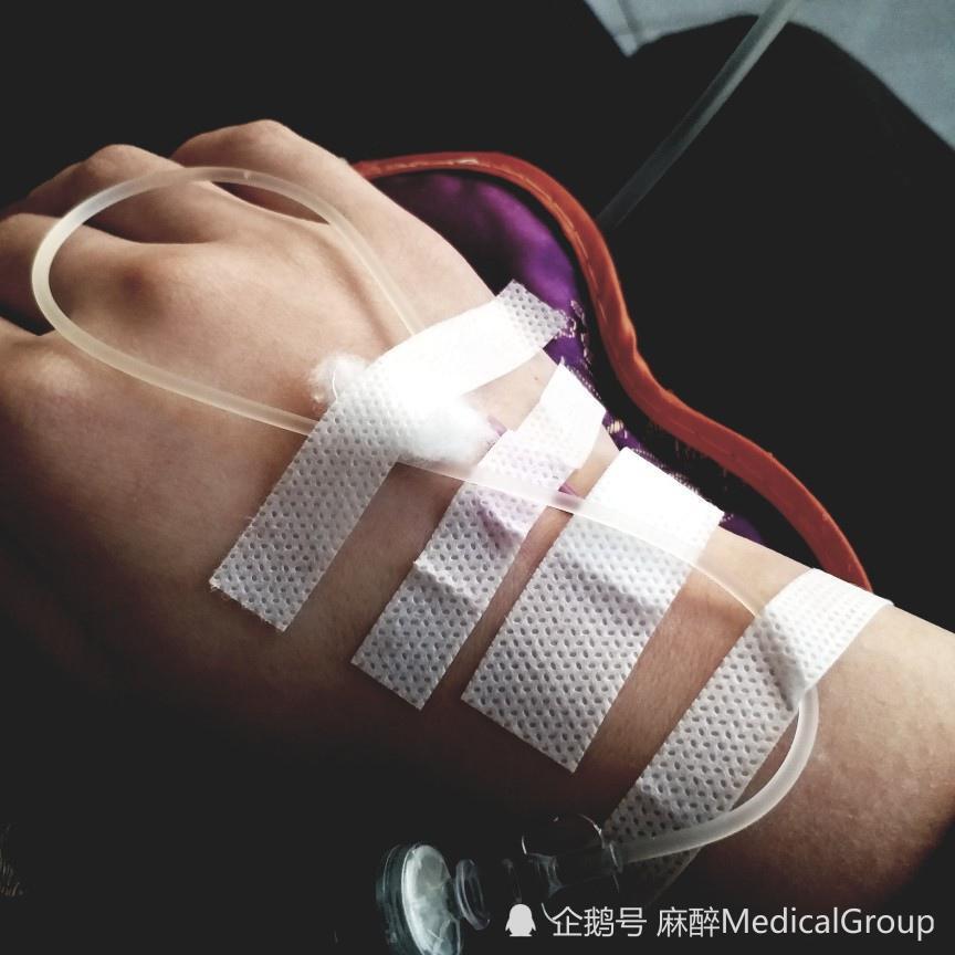 在冬季老年人输液真的可以疏通血管吗