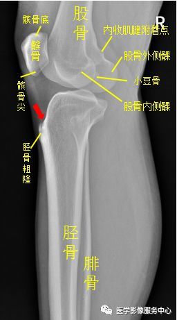 独立值班了这些骨折你都看出来了吗 附注解 腾讯新闻