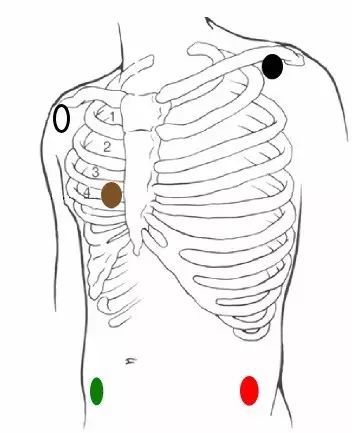 心电监护仪的8大操作要点 你掌握了几个 腾讯新闻