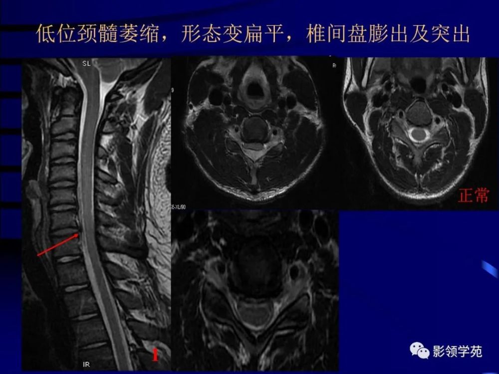 平山病 看一遍就不会忘 腾讯新闻