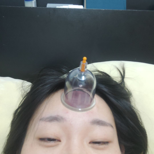 额头上拔了个火罐,现在感觉无欲无求,整个人都轻飘飘的,请问这正常吗?