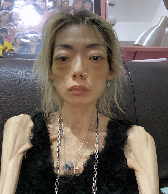 为嫁豪门放弃牛津,今全身瘫痪瘦成"骷髅",她错在了哪里?