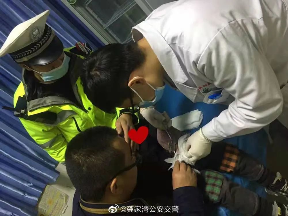 临洮一群众求助3岁小孩玩打火机不慎被炸伤手指紧急关头