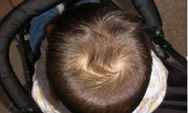 "双旋男孩找不到,双旋女孩没人要",孩子头上的旋有啥讲究