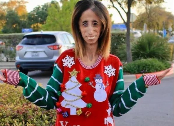 400万人咒她去死,这个"全球最丑的女人",竟这样报复他们……_腾讯新闻