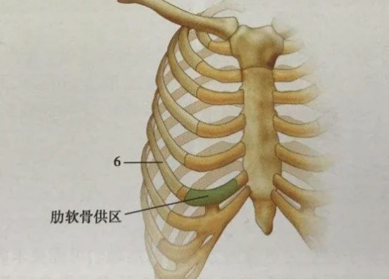 肋软骨隆鼻术后会发生弯曲的现象吗?