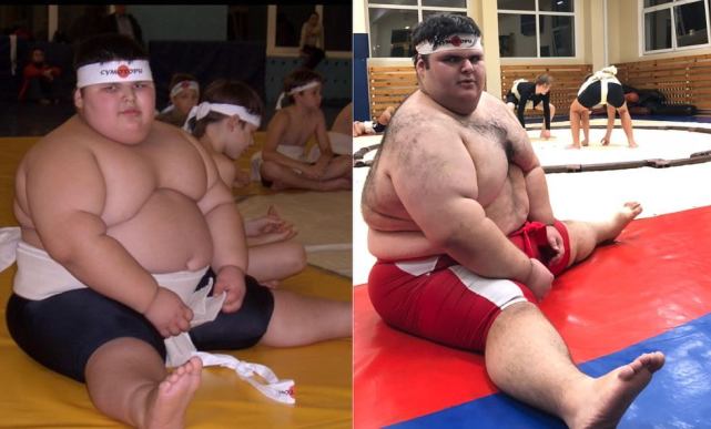 俄世界最胖孩子离世仅21岁出生体重标准九岁时近300斤