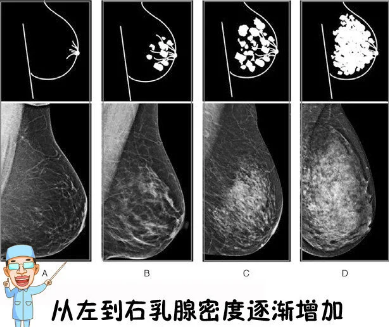 减肥胸减没了_减肥胸减没了怎么办_怎样减肥不减胸