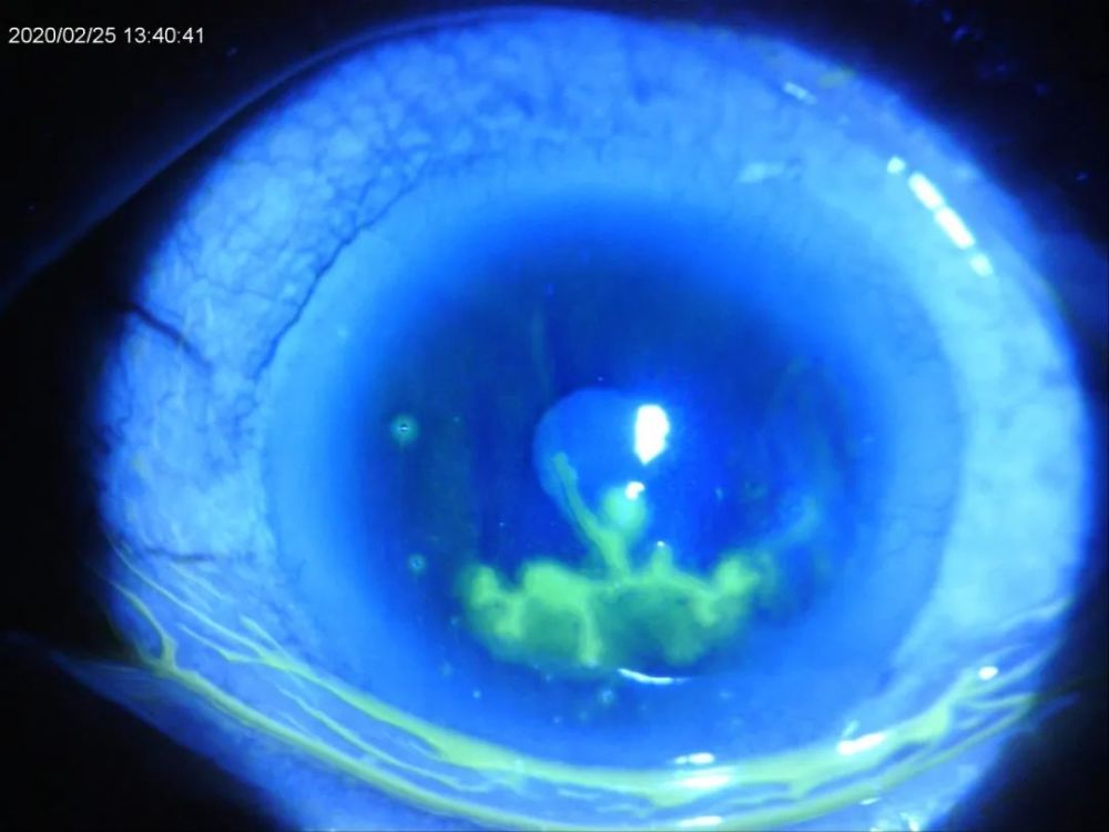 一图胜千言裂隙灯摄影大赛快来pick你心中的最佳摄影大师吧