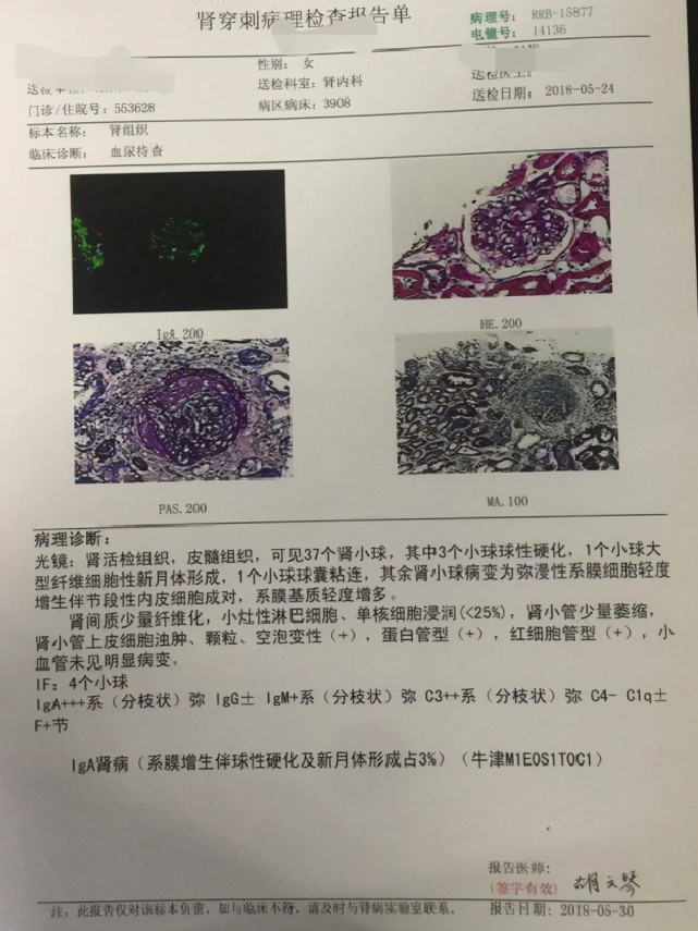 不会看肾穿刺报告吗?请看此文,简单明白