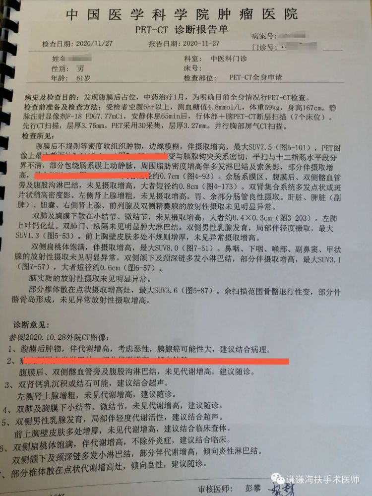 胰腺癌诊治病例分享