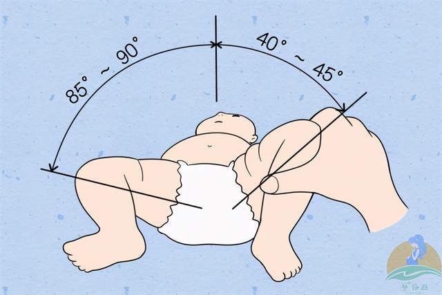 这两种都是腿纹不对称的常见表现,不过出现这些情况,并不代表宝宝发育