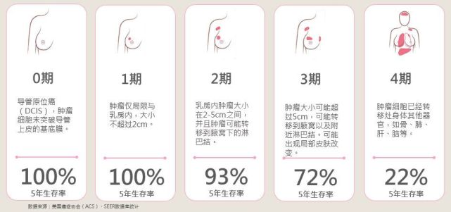 为什么要进行乳腺癌分期?乳腺癌是如何分期的?