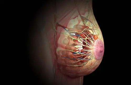 女性患有卵巢方面的疾病时同房会出现乳房刺痛的症状,例如:卵巢肿瘤