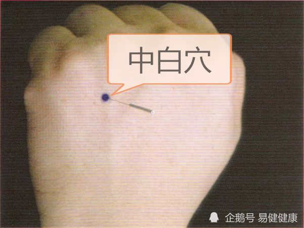 中医健康养生之人体手部穴中白穴