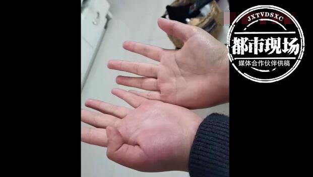 一位家长在电话中告诉记者,当天挨打的并不是个别孩子,而是6年级这个