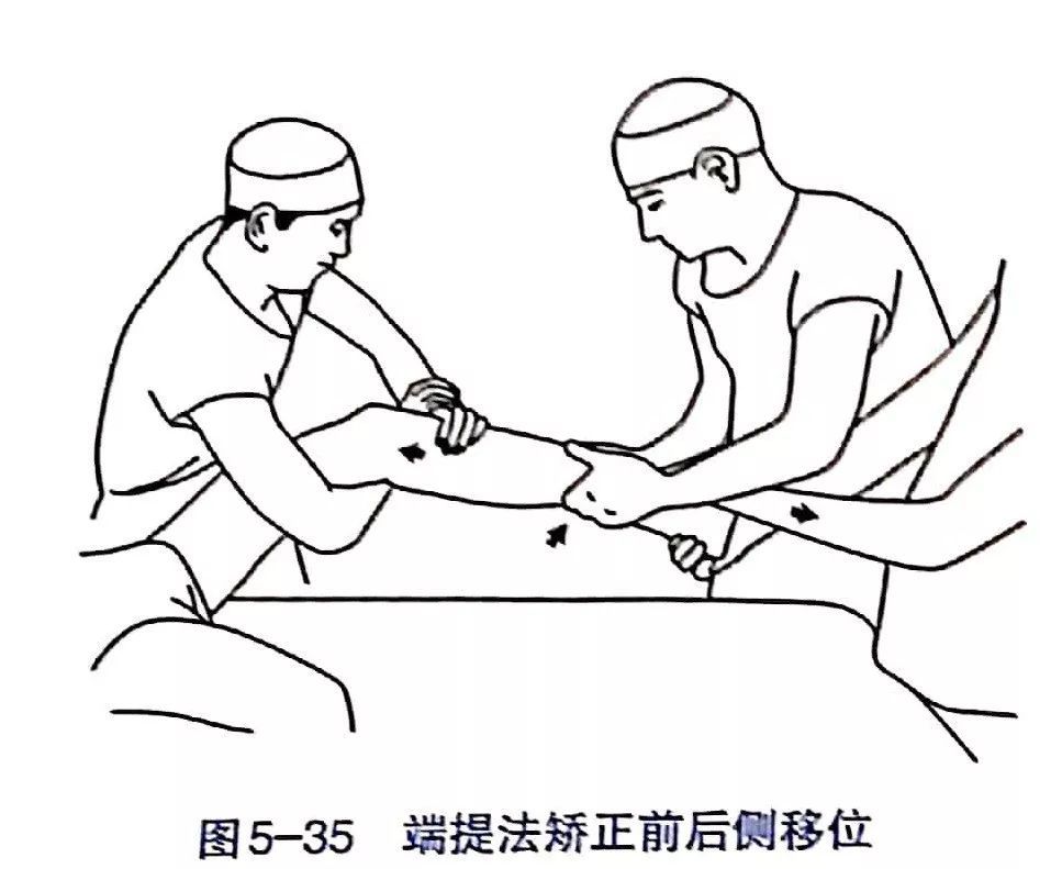 各部位骨折的完美复位手法你值得拥有