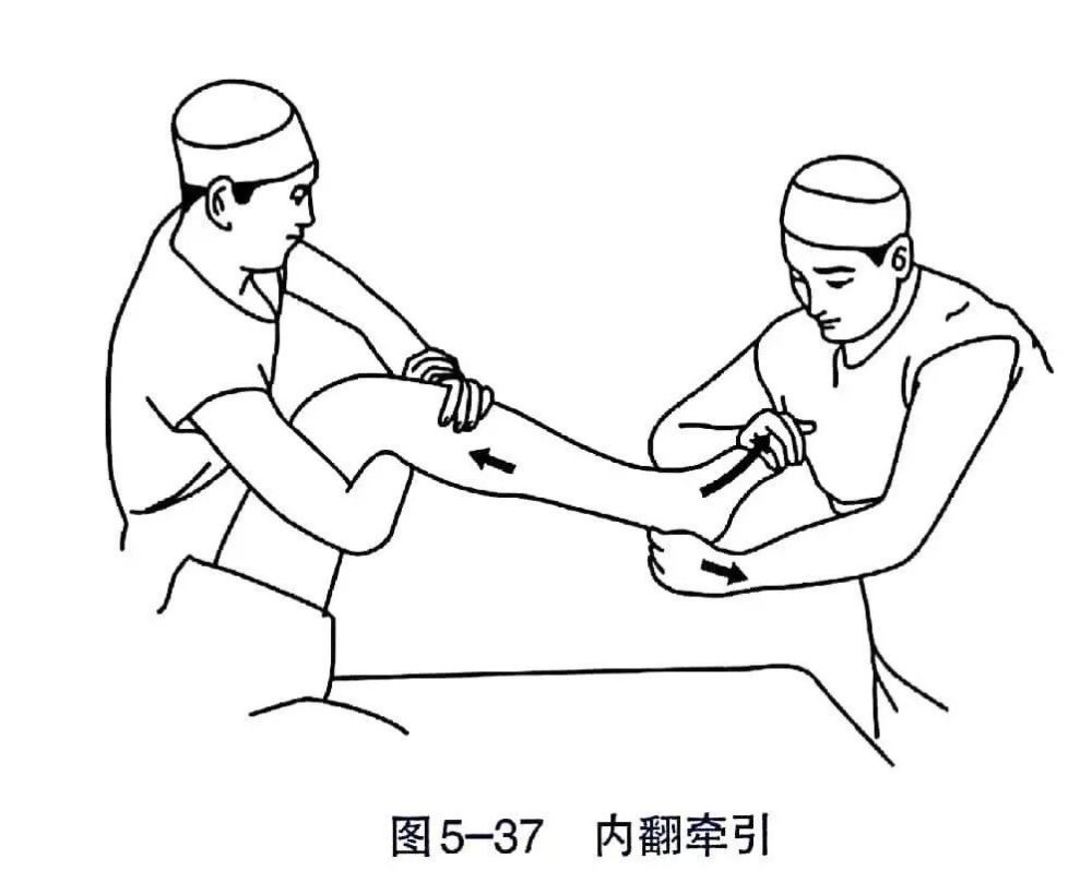 各部位骨折的完美复位手法你值得拥有