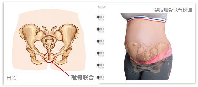 懷孕有一種痛 叫 恥骨聯合分離 健康呷1