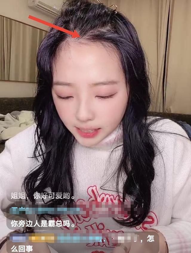 小娇妻郝一点也有烦恼发际线后移太严重提前加入秃头少女队伍