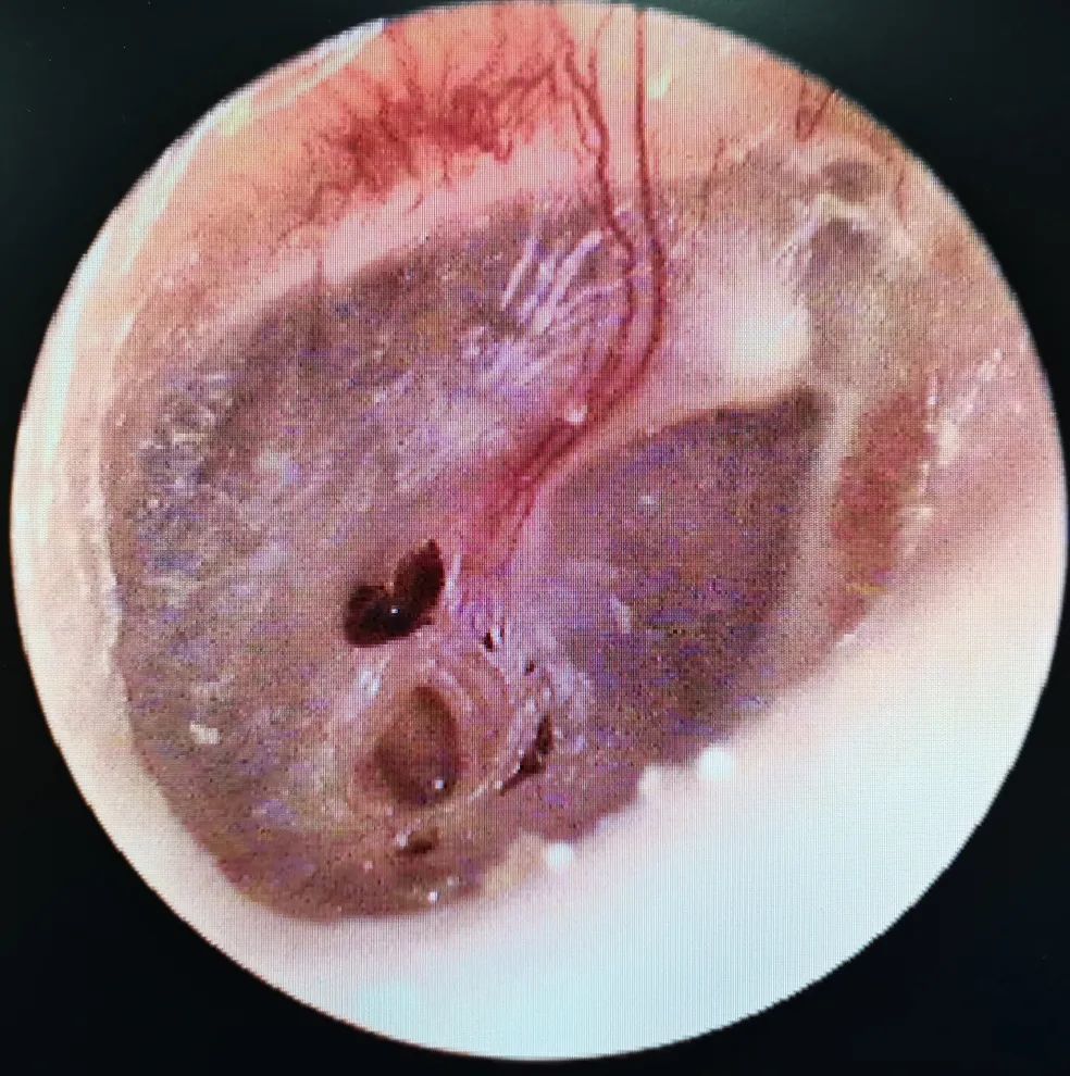 医生提醒,这些情况要警惕_腾讯新闻