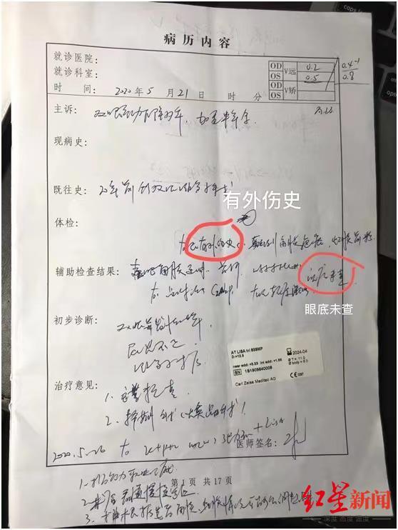 武汉抗疫医生：我躲过新冠病毒 没躲过视网膜脱落