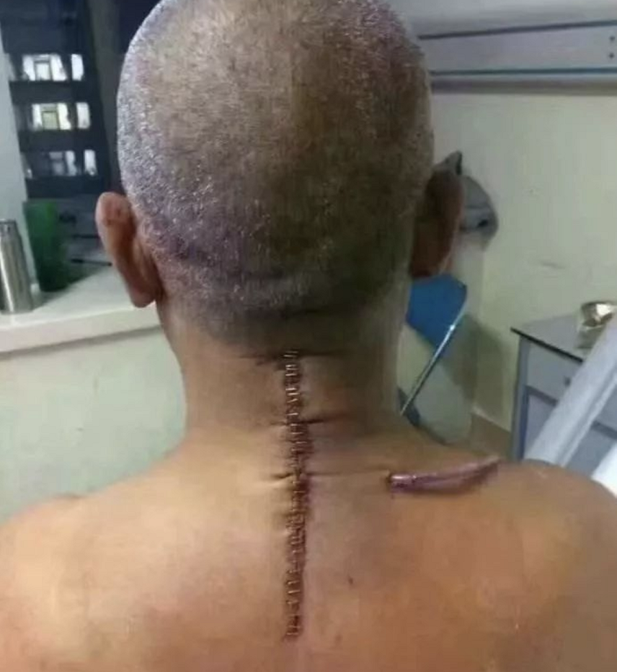 那么自然而然就知道,那些所谓的富贵包切除手术,都是